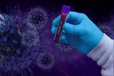 COVID-19 - PARCERIA/INQUÉRITO COM O INSTITUTO BUTANTÃ PERMITE A REALIZAÇÃO DE TESTES DIRECIONADOS A ALGUNS  FUNCIONÁRIOS